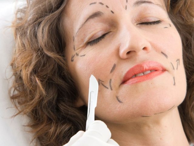 Quels sont les types de chirurgie esthétique du visage ?