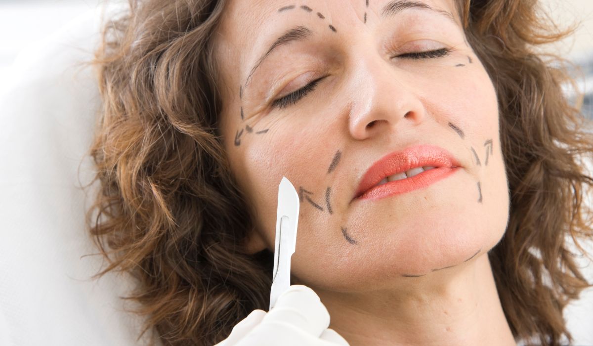 Quels sont les types de chirurgie esthétique du visage ?